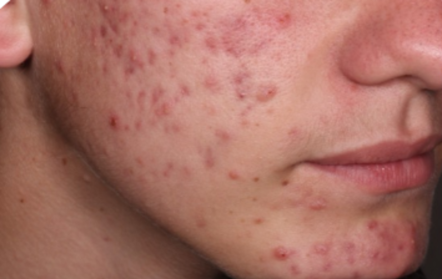 Before-and-after images of a CABTREO patient